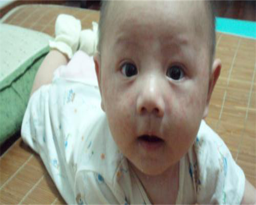 供卵助孕生儿子,输卵管堵塞的10个征兆，常痛经女性自查身体有一方法