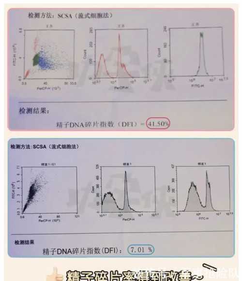 促排卵针打在身体的卵巢吗 促排卵针打在身体的卵巢吗有效果吗