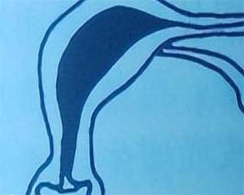 试管代孕生选性别,多囊卵巢要二胎-多囊卵巢二胎好怀孕吗！