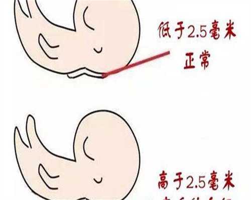 死精试管的成功率多少 死精做试管婴儿能成功吗