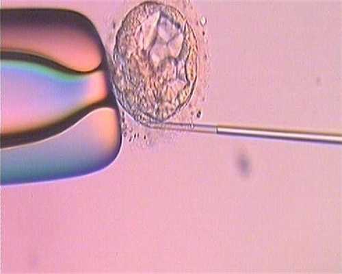 试管婴儿探查子宫环境有妙招,试管婴儿宫腔镜检查的目的