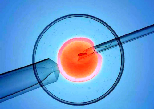 试管前检查输卵管造影吗？