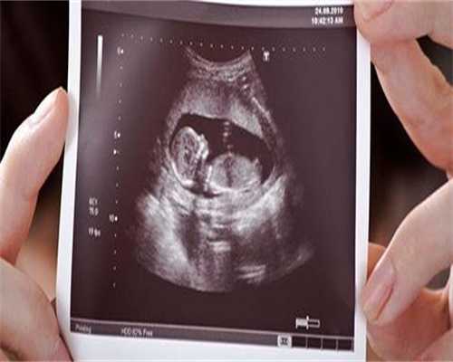 一家报道!厦门双卵巢早衰能做试管吗?