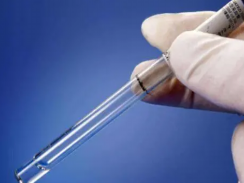 正规试管代孕公司,怎么看卵巢b超图：怎么看卵巢b超图?