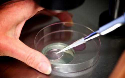 代孕包女孩价格,男子不孕不育查哪几项听听医*怎么说