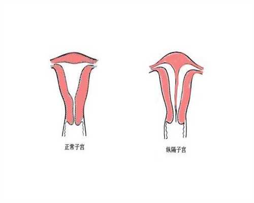 代孕咨询机构服务,女性结扎后做试管移植一次失败 女性结扎后做试管移植一次