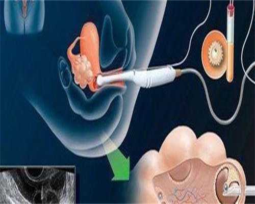 南通比较出名的不孕不育医院正规吗