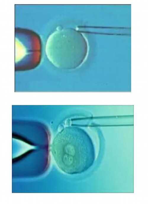 [分享一下]厦门输卵管切除了能做试管婴儿吗
